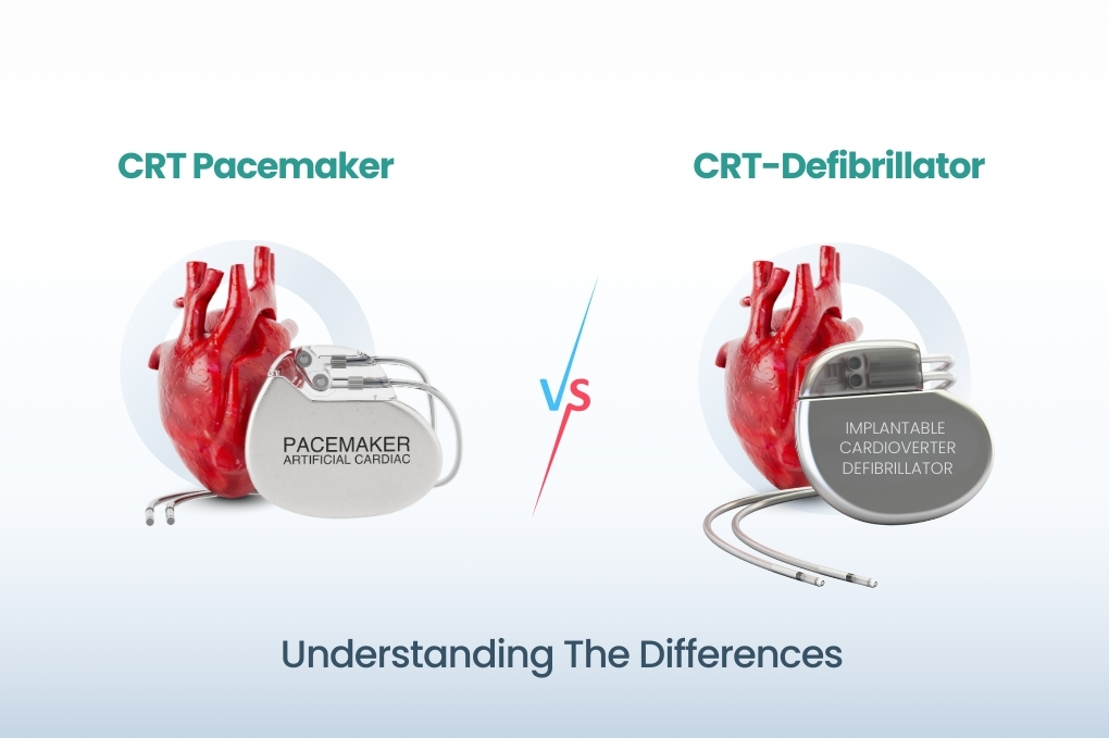 CRT Pacemaker vs. CRT-Defibrillator